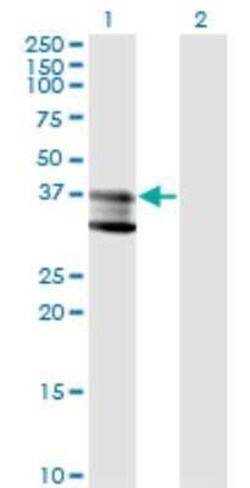 SMPD1 Antibody (4H2), Novus Biologicals 0.1 mg | Buy Online | Novus Biologicals | Fisher Scientific