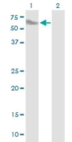 SMPDL3A Antibody, Novus Biologicals 0.05 mg | Buy Online | Novus Biologicals | Fisher Scientific