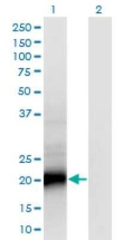 SMUG1 Antibody (4D5), Novus Biologicals 0.1 mg, Unconjugated:Anticorps,