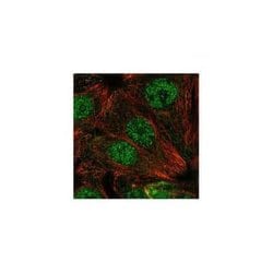 SMUG1 Rabbit anti-Human, Polyclonal, Novus Biologicals 100 &mu;g; Unconjugated:Antibodies,