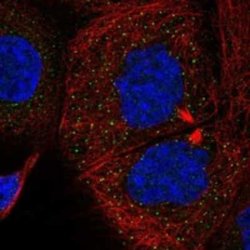 SMURF1 Rabbit anti-Human, Polyclonal, Novus Biologicals 25 &mu;g; Unconjugated:Antibodies,