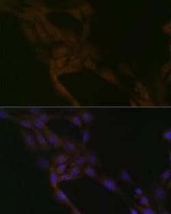 SMURF2 Rabbit anti-Human, Mouse, Clone: 8O7F0, Novus Biologicals 100 &mu;g;