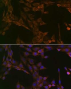SMYD3 Rabbit anti-Human, Mouse, Rat, Clone: 2P8Z2, Novus Biologicals 100