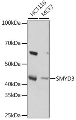 SMYD3 Rabbit anti-Human, Mouse, Rat, Clone: 2P8Z2, Novus Biologicals 100