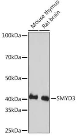 SMYD3 Rabbit anti-Human, Mouse, Rat, Clone: 2P8Z2, Novus Biologicals 100
