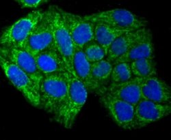 SMYD3 Rabbit anti-Human, Mouse, Rat, Clone: JM73-63, Novus Biologicals