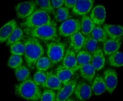 SMYD3 Rabbit anti-Human, Mouse, Rat, Clone: JM73-63, Novus Biologicals