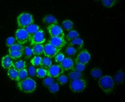 SMYD3 Rabbit anti-Human, Mouse, Rat, Clone: JM73-63, Novus Biologicals