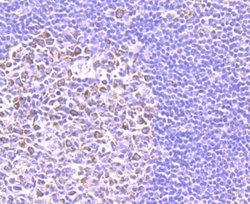 SMYD3 Rabbit anti-Human, Mouse, Rat, Clone: JM73-63, Novus Biologicals