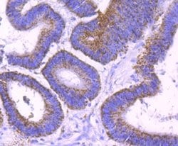 SMYD3 Rabbit anti-Human, Mouse, Rat, Clone: JM73-63, Novus Biologicals