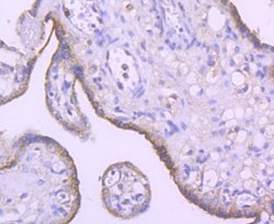 SMYD3 Rabbit anti-Human, Mouse, Rat, Clone: JM73-63, Novus Biologicals