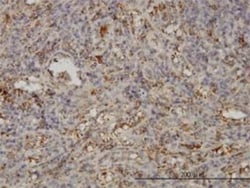 SNAP23 Antibody (2F5-3D4), Novus Biologicals 0.1 mg | Buy Online | Novus Biologicals | Fisher Scientific