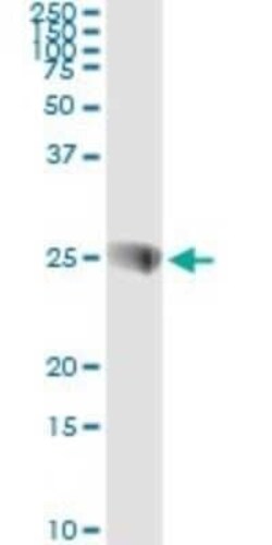 SNAP23 Antibody (2F5-3D4), Novus Biologicals 0.1 mg | Buy Online | Novus Biologicals | Fisher Scientific