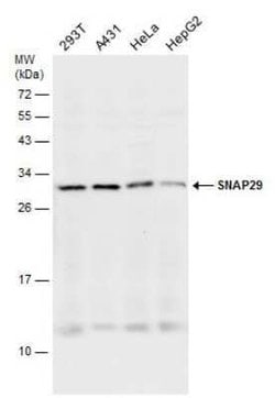 SNAP29 Antibody, Novus Biologicals 100 &mu;g; Unconjugated:Antibodies,