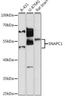 SNAP43 Antibody - Azide and BSA Free, Novus Biologicals:Antibodies:Primary