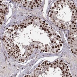 SNAP45 Antibody, Novus Biologicals:Antibodies:Primary Antibodies