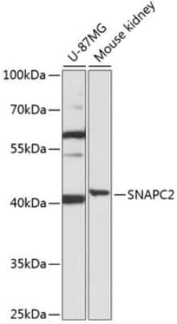 SNAP45 Antibody - Azide and BSA Free, Novus Biologicals 0.02 mL; Unconjugated:Antibodies,