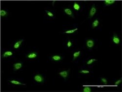 SNAPC4 Antibody (1D1), Novus Biologicals 0.1 mg | Buy Online | Novus Biologicals | Fisher Scientific