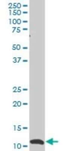 SNAPC5 Antibody (5C3), Novus Biologicals 0.1 mg | Buy Online | Novus Biologicals | Fisher Scientific