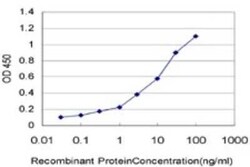 SNAPC5 Antibody (6G10), Novus Biologicals 0.1 mg | Buy Online | Novus Biologicals | Fisher Scientific