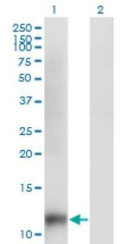 SNAPC5 Antibody (6G10), Novus Biologicals 0.1 mg | Buy Online | Novus Biologicals | Fisher Scientific