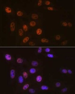 SNF5 Rabbit anti-Human, Mouse, Rat, Clone: 6X6T8, Novus Biologicals 100 &mu;g | Buy Online | Novus Biologicals | Fisher Scientific