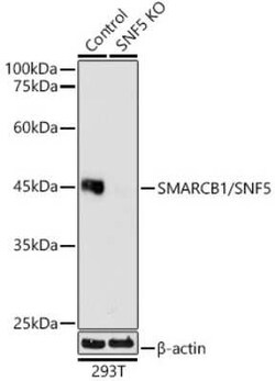 SNF5 Rabbit anti-Human, Mouse, Rat, Clone: 6X6T8, Novus Biologicals 100 &mu;g | Buy Online | Novus Biologicals | Fisher Scientific