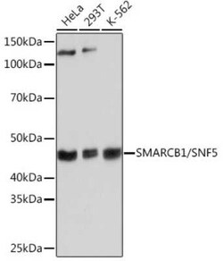 SNF5 Rabbit anti-Human, Mouse, Rat, Clone: 6X6T8, Novus Biologicals 100 &mu;g | Buy Online | Novus Biologicals | Fisher Scientific