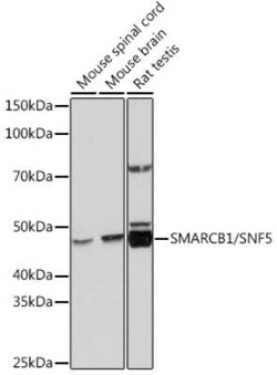 SNF5 Rabbit anti-Human, Mouse, Rat, Clone: 6X6T8, Novus Biologicals 100 &mu;g | Buy Online | Novus Biologicals | Fisher Scientific