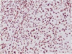 SNF5 Mouse anti-Human, Clone: SMARCB1/3984, Novus Biologicals 20 &mu;g | Buy Online | Novus Biologicals | Fisher Scientific