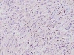 SNF5 Mouse anti-Human, Clone: rSMARCB1/4588, Novus Biologicals 20 &mu;g | Buy Online | Novus Biologicals | Fisher Scientific