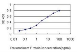 SNF5 Antibody (3E10), Novus Biologicals 0.1 mg | Buy Online | Novus Biologicals | Fisher Scientific