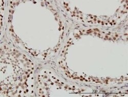 SNF5 Antibody (3E10), Novus Biologicals 0.1 mg | Buy Online | Novus Biologicals | Fisher Scientific