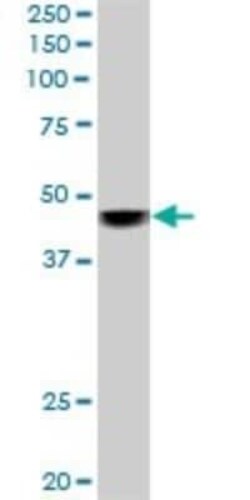 SNF5 Antibody (3E10), Novus Biologicals 0.1 mg | Buy Online | Novus Biologicals | Fisher Scientific