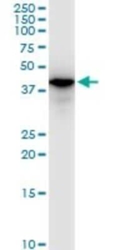 SNF5 Antibody (3E3), Novus Biologicals 0.1 mg | Buy Online | Novus Biologicals | Fisher Scientific