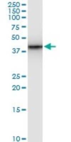 SNF5 Antibody (3E3), Novus Biologicals 0.1 mg | Buy Online | Novus Biologicals | Fisher Scientific