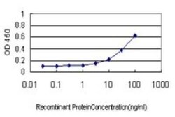 SNF8 Antibody (6B11), Novus Biologicals 0.1 mg | Buy Online | Novus Biologicals | Fisher Scientific