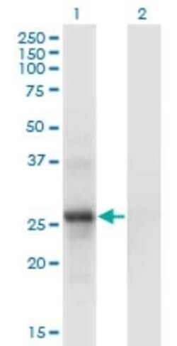 SNF8 Antibody (6B11), Novus Biologicals 0.1 mg | Buy Online | Novus Biologicals | Fisher Scientific