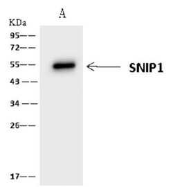 SNIP1 Antibody, Novus Biologicals 50 &mu;g, Unconjugated:Antibodies, Polyclonal