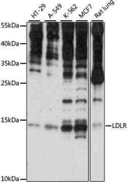 SNRNP25 Antibody - Azide and BSA Free, Novus Biologicals 0.02 mL; Unconjugated:Antibodies,