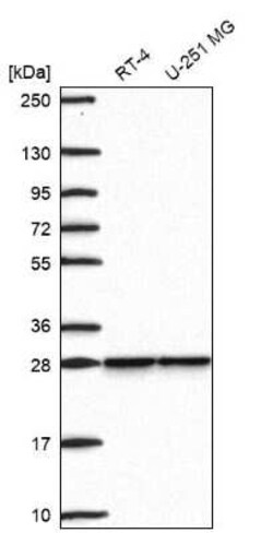 SNRPB2 Antibody, Novus Biologicals 100 &mu;g | Buy Online | Novus Biologicals | Fisher Scientific