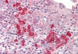 SNRPD1 Rabbit anti-Human, Polyclonal, Novus Biologicals 0.1ml; Unconjugated:Antibodies,