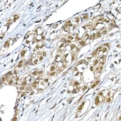 SNRPD1 Antibody - Azide and BSA Free, Novus Biologicals:Antibodies:Primary