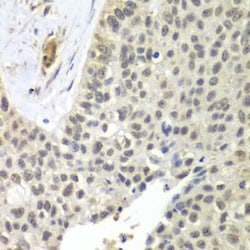 SNRPD2 Antibody - BSA Free, Novus Biologicals:Antibodies:Primary Antibodies