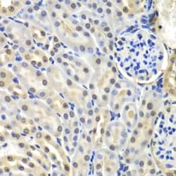 SNRPD2 Antibody - BSA Free, Novus Biologicals:Antibodies:Primary Antibodies