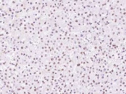 SNRPD2 Antibody, Novus Biologicals:Antibodies:Primary Antibodies