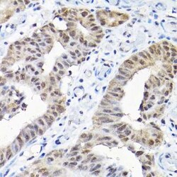 SNRPF Antibody - Azide and BSA Free, Novus Biologicals 0.1 mL | Buy Online | Novus Biologicals | Fisher Scientific