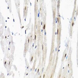 SNRPF Antibody - Azide and BSA Free, Novus Biologicals 0.1 mL | Buy Online | Novus Biologicals | Fisher Scientific
