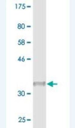 SNRPG Antibody (2F1-1F12), Novus Biologicals 0.1 mg | Buy Online | Novus Biologicals | Fisher Scientific