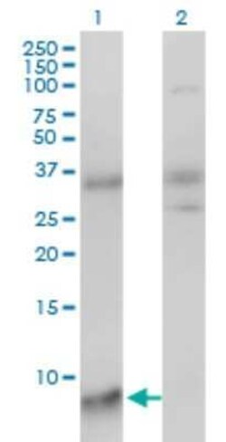 SNRPG Antibody (2H8-1C12), Novus Biologicals 0.1 mg | Buy Online | Novus Biologicals | Fisher Scientific